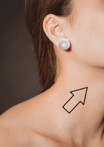 sinus karotikus, masaža sinusa, lupanje srca